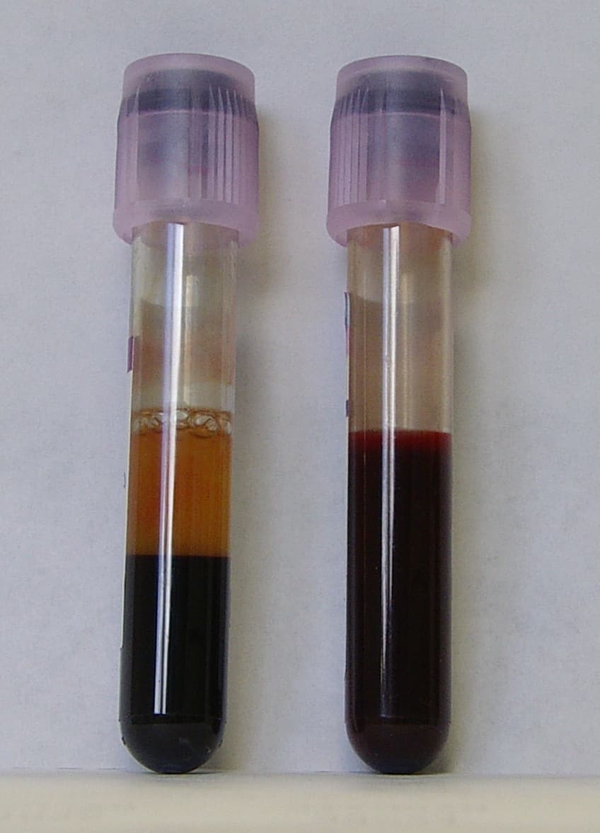 Cuesta de la Sangre